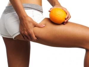 cellulite-rimedi-naturali